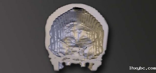 3dmodel of skull