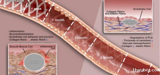 Article_Bio Scaffold_2